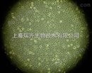 中国仓鼠X 小鼠B 淋巴细胞杂交瘤MR1 derivative of HB-11048细胞 35.1